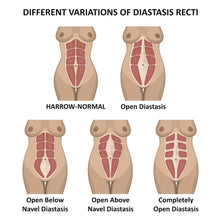 Lade das Bild in den Galerie-Viewer, Rektusdiastase-Training